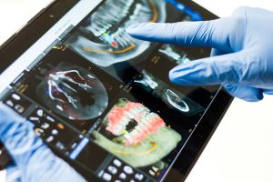 Chirurgia stomatologiczna – kluczowe informacje i najczęstsze zabiegi